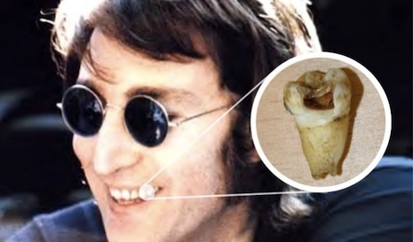 John Lennon's Tooth