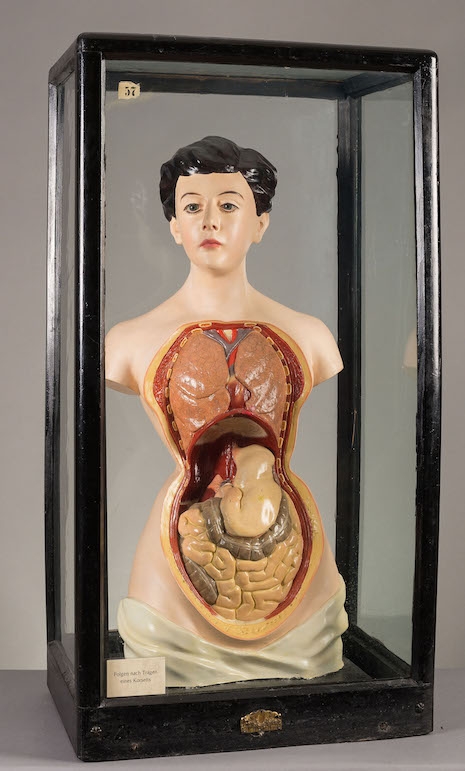 A female anatomical figure displaying the effects of wearing tight corseting