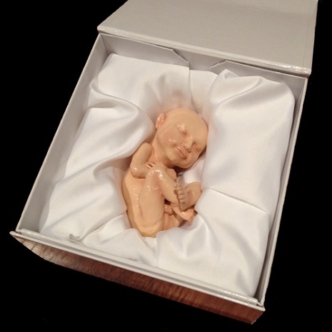 3-D fetus