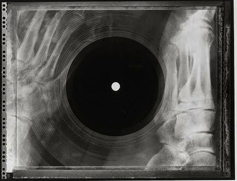 X-ray records