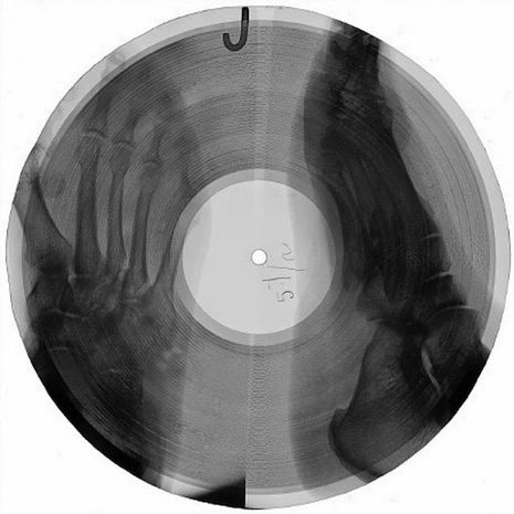X-ray records
