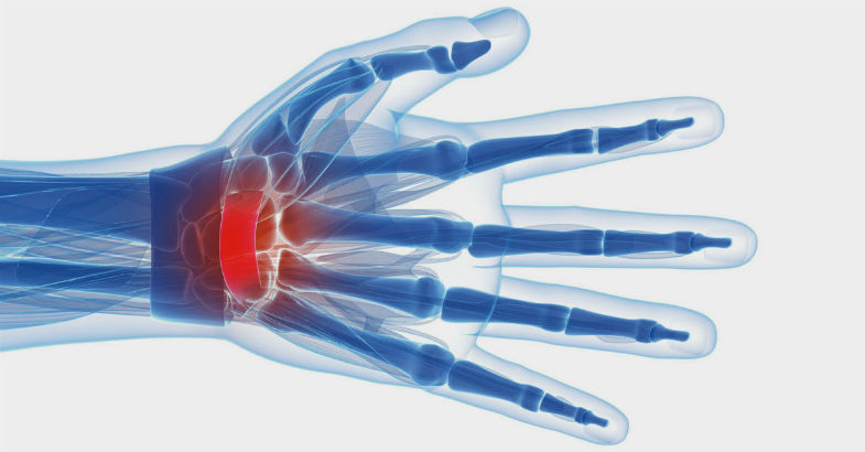 The AMAZING $20 cure for Carpal Tunnel Syndrome and wrist pain