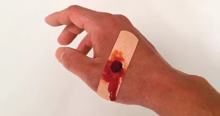 Check out ‘Boo-boos,’ gory band-aids for grosser healing