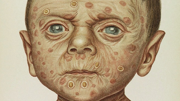 Bloody Disgusting: A gruesome gallery of vintage medical illustrations from the 1800s