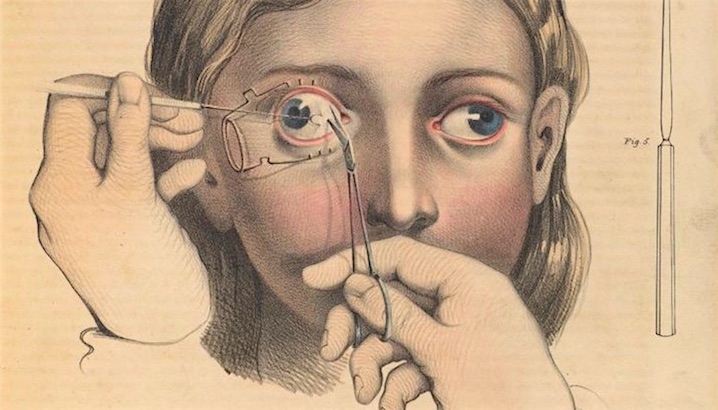 Not for the faint-hearted: Gruesome medical illustrations from the 19th-century (NSFW)