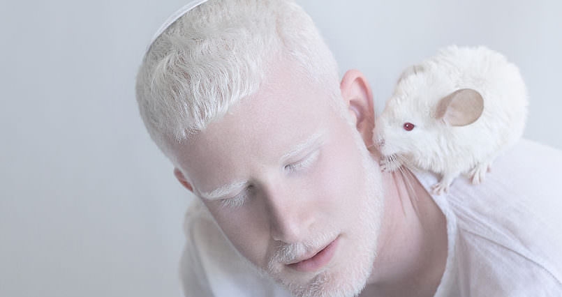 ‘Porcelain Beauty’: Alluring portraits of albinos