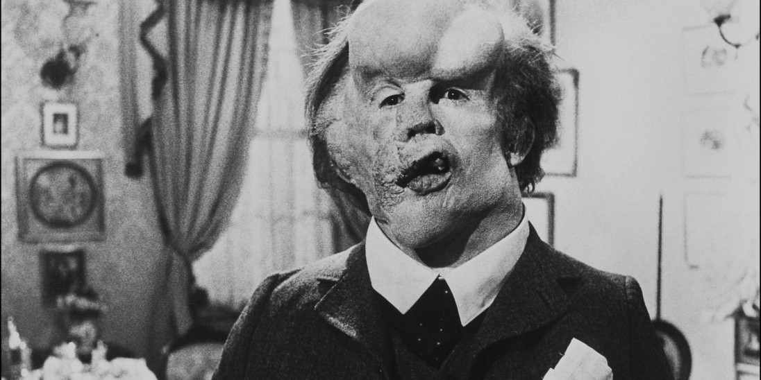 How they brought ‘The Elephant Man’ back to life