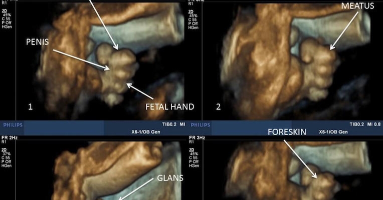 Prenatal fun: 3D ultrasounds show that male fetuses masturbate