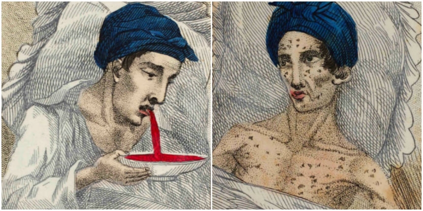 Dead at 17: ‘The Fatal Consequences of Masturbation’—a handy guide from 1830