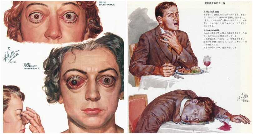 The morbidly beautiful medical illustrations of Dr. Frank Netter