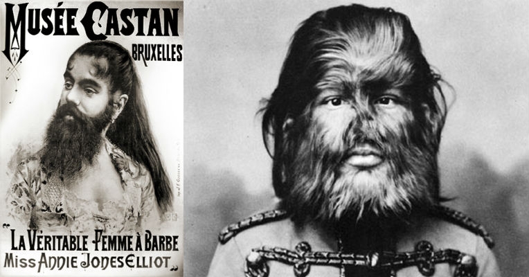 True tales of the original Bearded Lady and Dog-Faced Boy