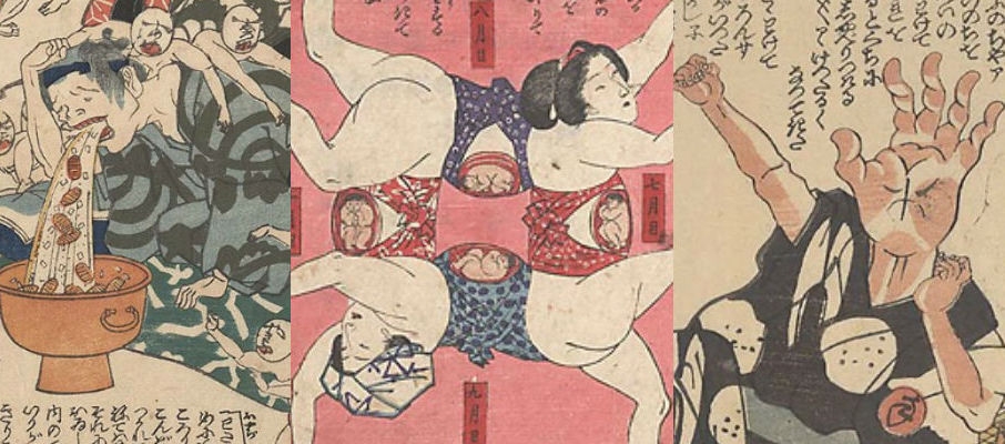 Curious depictions of syphilis, measles, gonorrhea & other diseases from 19th-century Japan