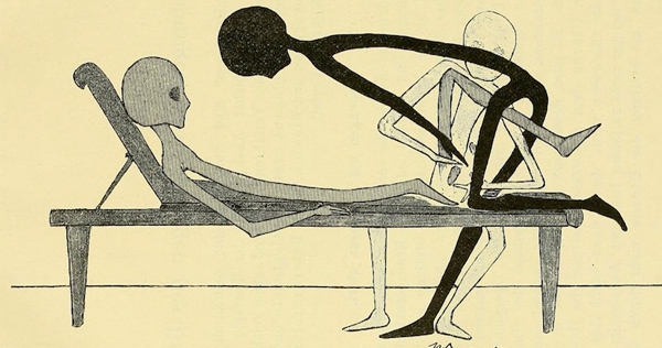 Evidence from 1895 that alien ‘Greys’ walked among us and practiced gynecology?