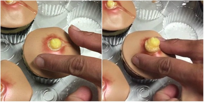 There are cupcakes you can squeeze that look like giant pimples