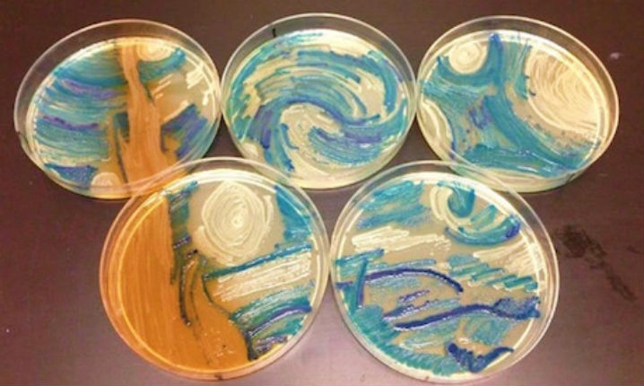 The art of ‘EWWW’: Artwork created using bacteria as its medium
