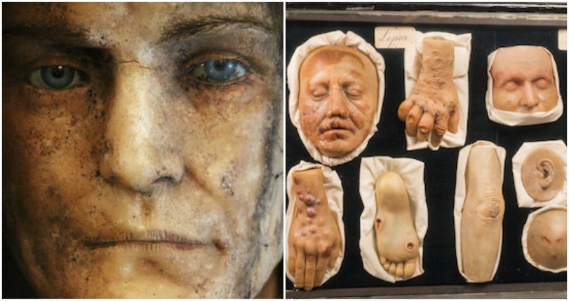 Serial killers, death masks and other strange 100-year-old wax anatomical anomalies