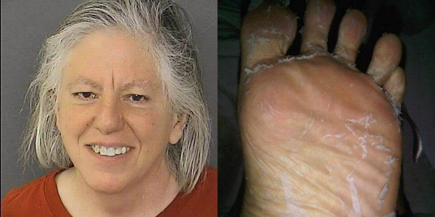 Woman charged with serving milk contaminated with dead foot skin shavings