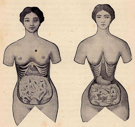 What extreme corsetry does to the human body